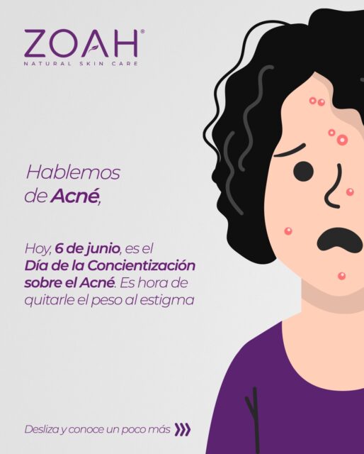 💜 Hoy es el Día de la Concientización sobre el Acné y queremos recordarte algo: la piel real tiene texturas, procesos y cambios. Y eso está bien. ✨
Nuestra Línea Acné Rescue está formulada para equilibrar la barrera cutánea y así sanar tu piel.
#ZoahSkin #PielReal #SkinPositivity #CuidadoDeLaPiel